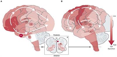 Pathophysiological Underpinnings of Extra-Motor Neurodegeneration in Amyotrophic Lateral Sclerosis: New Insights From Biomarker Studies